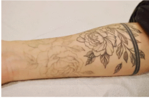 Cover-Up to Clean Slate