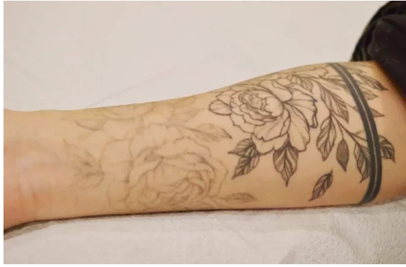 Cover-Up to Clean Slate